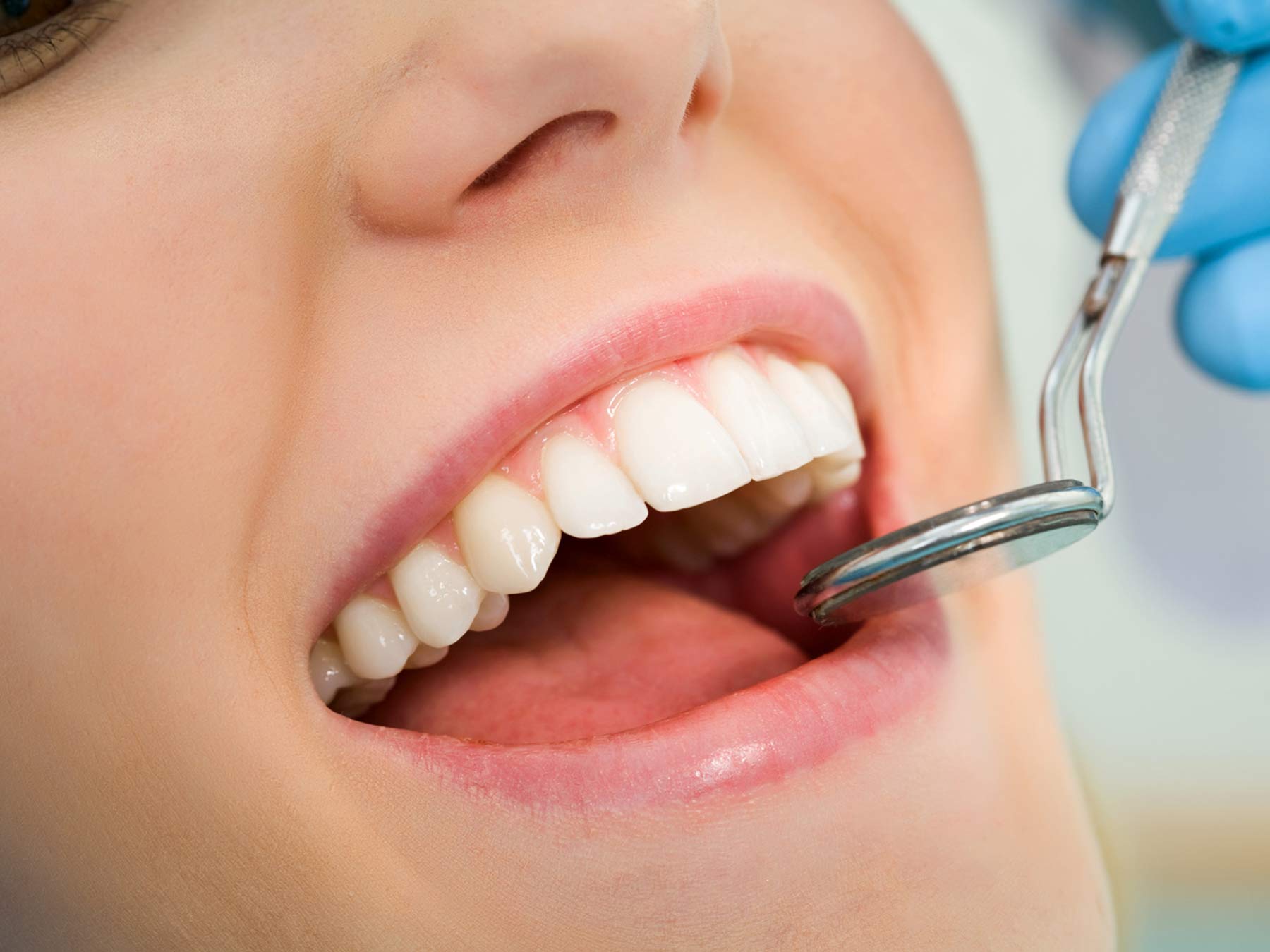 Eine umfangreiche Kontrolle die für die Gesundheit ihrer Zähne garantiert.